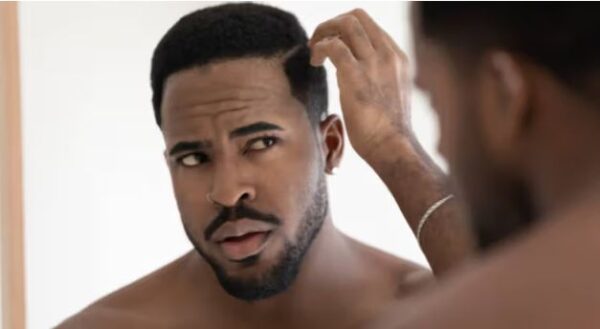 Stress and 5 other unexpected causes of dandruff